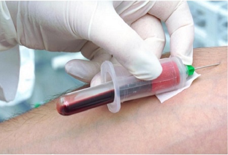 
			
		نحوه و زمان انجام فصد خون + مزایا و معایب
		فصد خون چیست و چه کاربرد‌هایی دارد؟ 