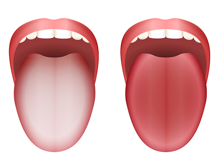 
			
		عوامل ایجاد زبان سفید و چگونگی درمان سفیدی زبان
		