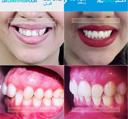 متخصص ارتودنسی خوب,دندانپزشک خوب,متخصص ارتودنسی خوب در تهران