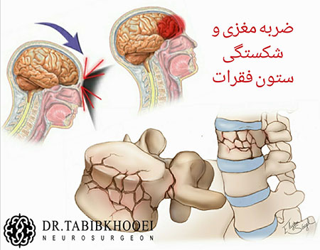 جراح مغز و اعصاب و ستون فقرات جراحی مغز و اعصاب,جراح مغز و اعصاب در ایران