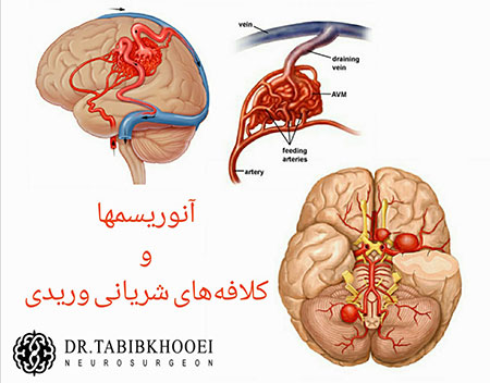 جراحی مغز جراحی مغز و اعصاب,جراح مغز و اعصاب در ایران