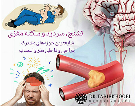 متخصص داخلی مغز و اعصاب جراحی مغز و اعصاب,جراح مغز و اعصاب در ایران