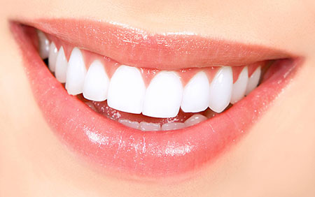 
			
		سفید کننده دندان
		