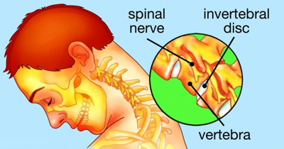 
			
		چند راه حل برای رهایی از گردن درد 
		