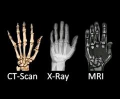 مقایسه جامع اشعه ایکس، ام‌آرآی و سی‌تی‌اسکن: مزایا و معایب هر روشتصویربرداری با اشعه ایکس چیست؟سی‌تی‌اسکن چیست؟ام‌آرآی چیست؟شباهت‌ها و تفاوت‌ها بین سه نوع اصلی تصویربرداری تشخیصیسوالات متداول درباره مقایسه اشعه ایکس، ام‌آرآی و سی‌تی‌اسکنسخن پایانی