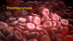 
ترومبوسیتوز؛همه چیز درباره بالا بودن پلاکت خون انواع ترومبوسیتوزعوارض ترومبوسیتوزتشخیص ترومبوسیتوزدرمان ترومبوسیتوز سوالات متداول درباره ترومبوسیتوزدرنگی بر یافته‌ها