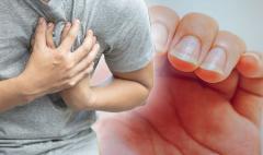 
			
		دستان شما 5 علامت بیماری قلبی را آشکار می کند
		علایم مشکلات قلبی در دستان شما