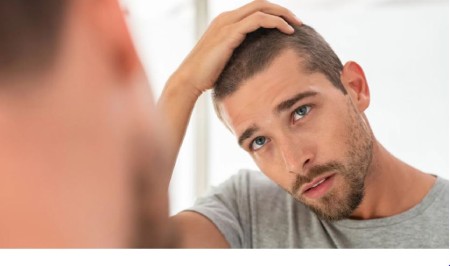 پیشنهادات برای کاهش تورم صورت بعد از پیوند مو