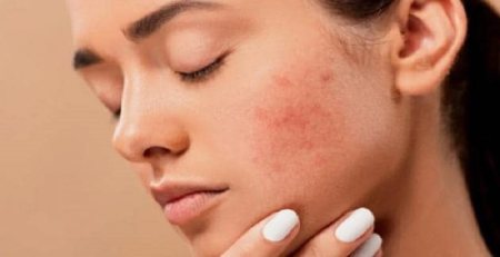مراقب پوست صورت روش های کاهش چین و چروک پوست,مراقب پوست صورت