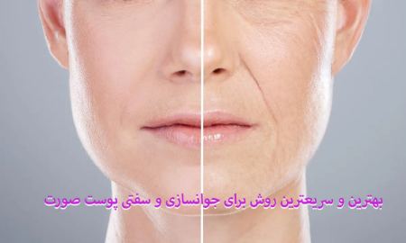 بهترین روش جوانسازی و سفتی پوست صورت چیست؟آیا جوانسازی پوست صورت باعث سفتی پوست می شود؟جوانسازی و سفت کردن پوست صورت بدون جراحیروش های خانگی و سریع برای جوانسازی و سفت شدن پوست صورتمقایسه روش های مختلف جوانسازی و سفتی پوست صورت