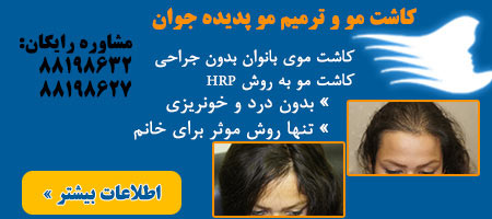 ترمیم و کاشت مو کاشت مو,ترمیم مو,عکس کاشت مو