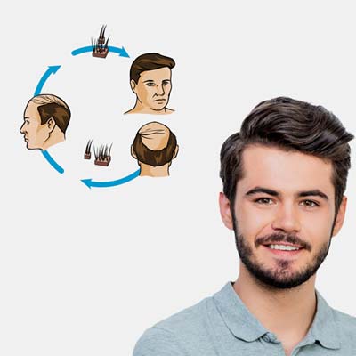 
			
		تفاوت کاشت مو به روش های مختلف
		