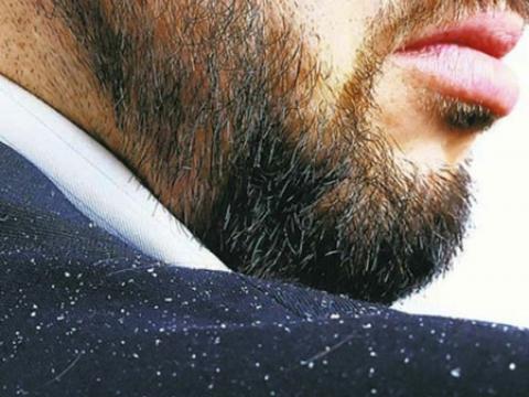 
			
		راه حل های سریع برای رفع شوره ریش آقایان
		آنچه که باید درباره شوره ریش آقایان بدانید