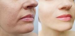 شیوه رفع افتادگی گوشه لب با آرایشبهترین روشهای آرایشی برای رفع افتادگی گوشه لب :نکاتی برای استفاده از روشهای آرایشی رفع افتادگی گوشه لبانتخاب روش مناسبنکاتی برای حفظ زیبایی لب‌هاسوالات متداول درباره روشهای آرایشی رفع افتادگی گوشه لبخلاصه: