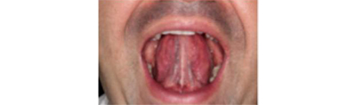 
			
		6 ورزش دهان برای جلوگیری از خر و پف
		