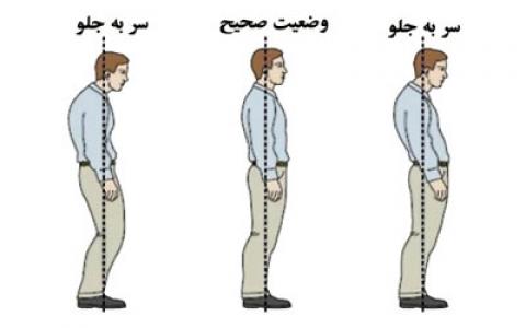
			
		ناهنجاری سر به جلو و حرکات اصلاحی (+عکس)
		