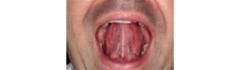 
			
		6 ورزش دهان برای جلوگیری از خر و پف
		