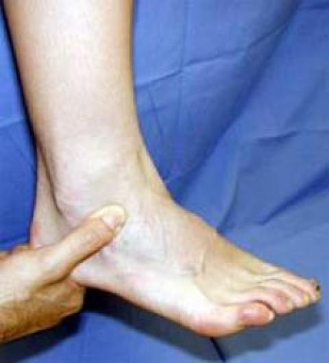
			
		 اگر مچ پایتان آسیب دید چه کنید؟
		