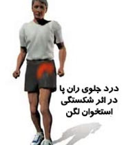 
			
		19 ورزش برای جلوگیری از شکستگی لگن
		